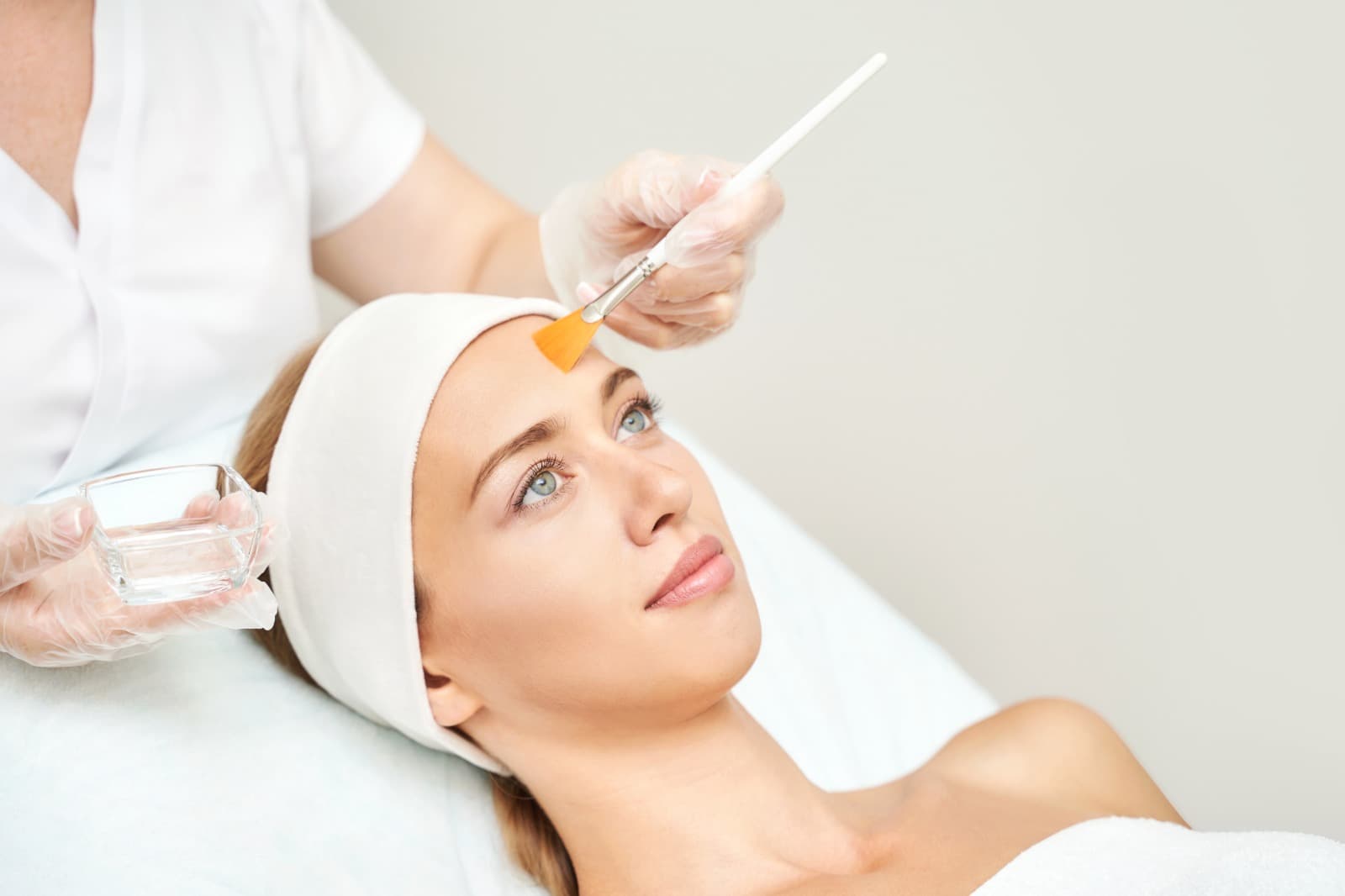 Medium Chemical Peel